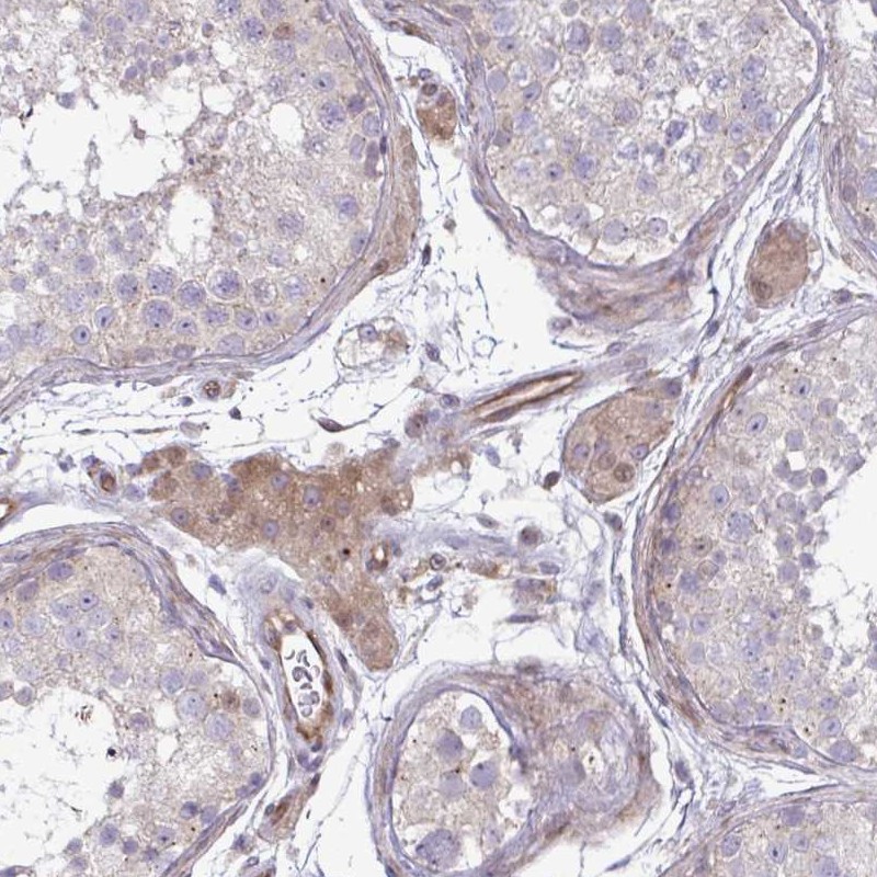 Anti-ZSCAN9 Antibody