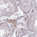 Anti-ZSCAN9 Antibody