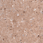 Immunohistochemical staining of human cerebral cortex shows moderate cytoplasmic and membranous positivity in neurons and neuropil.
