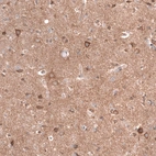 Immunohistochemical staining of human cerebral cortex shows moderate cytoplasmic and membranous positivity in neurons and neuropil.