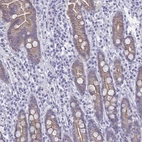 Anti-GLB1L2 Antibody