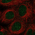 Immunofluorescent staining of human cell line HEK 293 shows localization to nucleus & vesicles.