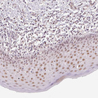 Immunohistochemical staining of human oral mucosa shows moderate nuclear positivity in squamous epithelial cells.