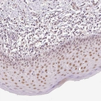 Immunohistochemical staining of human oral mucosa shows moderate nuclear positivity in squamous epithelial cells.