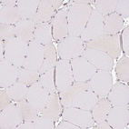Immunohistochemical staining of human skeletal muscle shows no positivity in myocytes as expected.