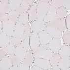 Immunohistochemical staining of human skeletal muscle shows no positivity in myocytes as expected.
