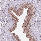 Immunohistochemical staining of human urinary bladder shows strong nuclear positivity in squamous epithelial cells.