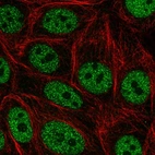 Immunofluorescent staining of human cell line MCF7 shows localization to nucleoplasm.