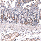 Immunohistochemical staining of human duodenum shows moderate cytoplasmic and membranous positivity in glandular cells.