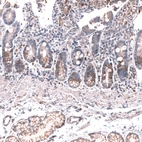 Immunohistochemical staining of human duodenum shows moderate cytoplasmic and membranous positivity in glandular cells.