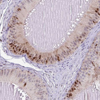 Immunohistochemical staining of human epididymis shows strong nuclear positivity in glandular cells.