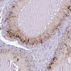 Immunohistochemical staining of human epididymis shows strong nuclear positivity in glandular cells.