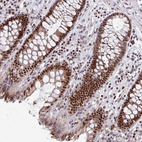 Immunohistochemical staining of human colon shows strong nuclear positivity in glandular cells.
