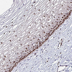 Immunohistochemical staining of human cervix, uterine shows strong nuclear positivity in squamous epithelial cells.
