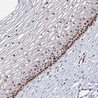 Immunohistochemical staining of human cervix, uterine shows strong nuclear positivity in squamous epithelial cells.