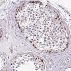 Immunohistochemical staining of human testis shows moderate nuclear positivity in cells in seminiferous ducts.