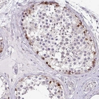 Immunohistochemical staining of human testis shows moderate nuclear positivity in cells in seminiferous ducts.