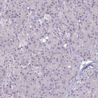 Anti-C19orf43 Antibody