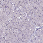 Immunohistochemical staining of human pancreas shows no positivity in exocrine glandular cells as expected.