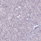 Immunohistochemical staining of human pancreas shows no positivity in exocrine glandular cells as expected.