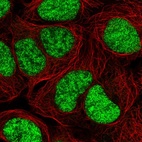Immunofluorescent staining of human cell line HEK 293 shows localization to nucleoplasm.