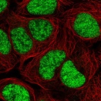 Anti-C19orf43 Antibody