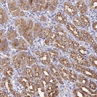 Anti-ZIK1 Antibody