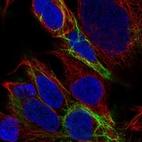 Immunofluorescent staining of human cell line HEK 293 shows localization to intermediate filaments.