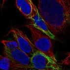 Immunofluorescent staining of human cell line HEK 293 shows localization to intermediate filaments.