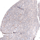 Immunohistochemical staining of human tonsil shows mainly very weak positivity in non-germinal center cells.