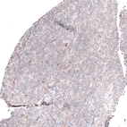 Immunohistochemical staining of human tonsil shows mainly very weak positivity in non-germinal center cells.