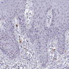 Anti-MS4A2 Antibody