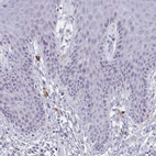 Immunohistochemical staining of human skin shows moderate cytoplasmic positivity in myelopoietic cells.