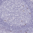 Immunohistochemical staining of human tonsil shows moderate to strong cytoplasmic positivity in myelopoietic cells.