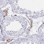Immunohistochemical staining of human testis shows moderate cytoplasmic positivity in Leydig cells.
