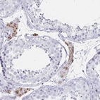 Immunohistochemical staining of human testis shows moderate cytoplasmic positivity in Leydig cells.