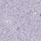 Immunohistochemical staining of human pancreas shows no positivity in exocrine glandular cells as expected.
