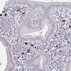 Anti-MS4A2 Antibody