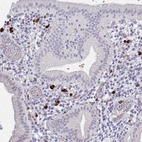 Immunohistochemical staining of human gallbladder shows strong cytoplasmic positivity in myelopoietic cells.