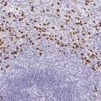 Anti-MAMDC4 Antibody