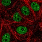Immunofluorescent staining of human cell line MCF7 shows localization to nucleoplasm.