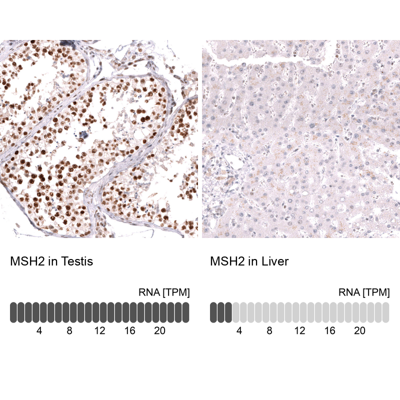 Anti-MSH2 Antibody