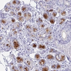 Immunohistochemical staining of human salivary gland shows moderate cytoplasmic positivity in glandular cells.