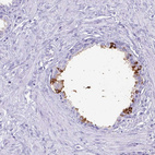 Anti-LTF Antibody