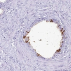Immunohistochemical staining of human prostate shows moderate cytoplasmic positivity in glandular cells.