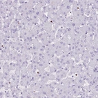 Immunohistochemical staining of human liver shows no positivity in hepatocytes as expected.