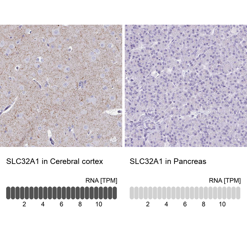 Anti-SLC32A1 Antibody
