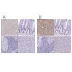Immunohistochemical staining of human cerebral cortex, colon, lymph node and pancreas using Anti-SLC32A1 antibody HPA059985 (A) shows similar protein distribution across tissues to independent antibody HPA058859 (B).