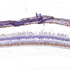 Immunohistochemical staining of human eye, retina shows strong cytoplasmic positivity in Inner plexiform layer.