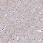 Immunohistochemical staining of human cerebral cortex shows moderate granular cytoplasmic positivity in neuropil.